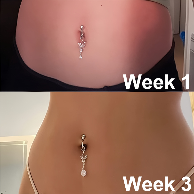 📢🦋2026 𝐂𝐙𝐓𝐈𝐂𝐋𝐄® Lymphvity MagneTherapy Germanium Belly Button Rings (✨Pain-free non-piercing design)