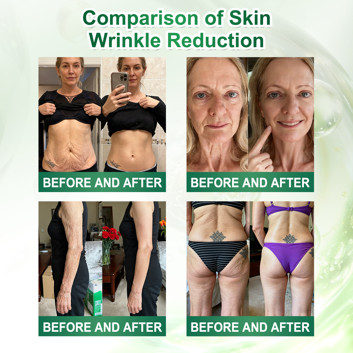 🔥 New Arrival | Curalona® Lymphatic Detox × Berberine 12-in-1 Sculpting Serum Eliminate toxins, burn stubborn fat, smooth wrinkles, and support joint comfort. (1 application daily — notice a lighter body & detoxed skin in as little as 7 days)