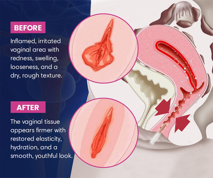 📢Curalona® Instant Itching Stopper & Detox and Slimming & Firming Repair & Pink and Tender Natural Capsules PRO
