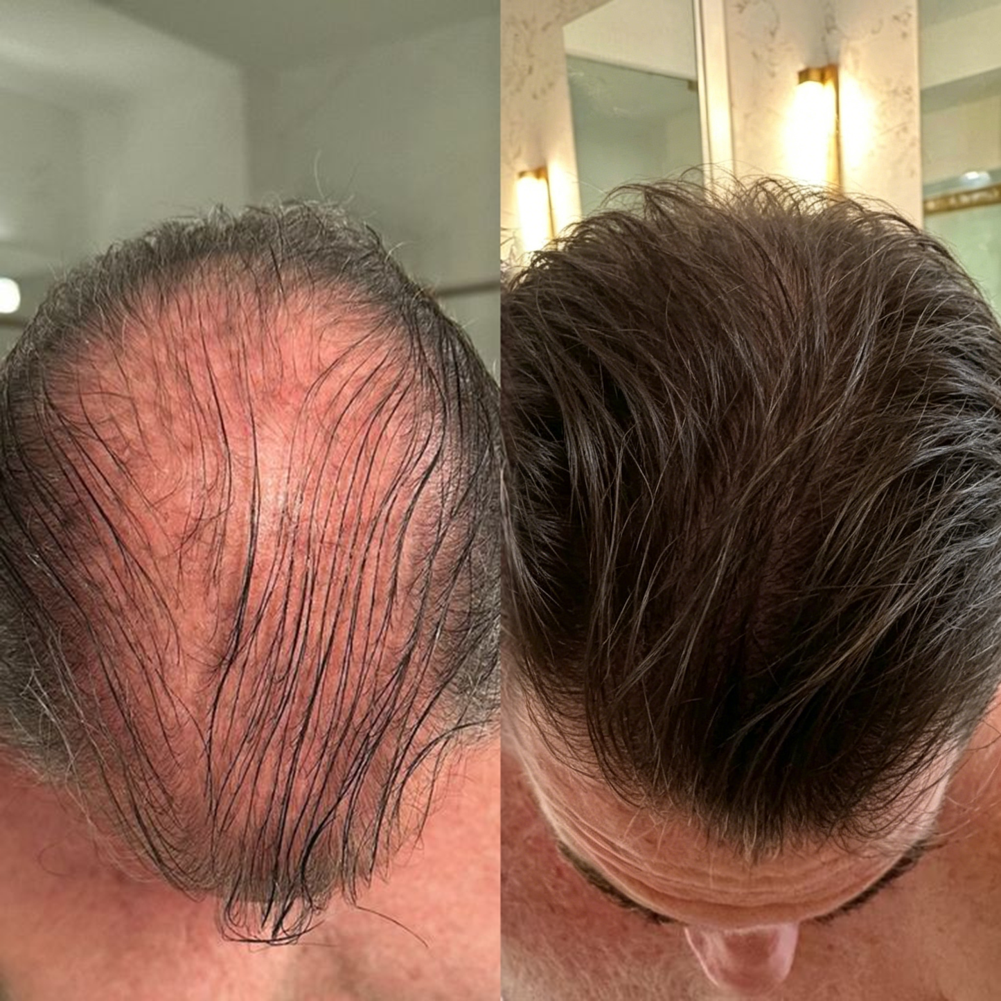 🌿👨‍⚕️ Tienda oficial en EE. UU. 🇺🇸 | 🔥 Champú y acondicionador 2 en 1 PURELORA® de cebolla y romero con complejo activo 15X para el crecimiento capilar: para un cabello con apariencia más gruesa, abundante y fuerte.