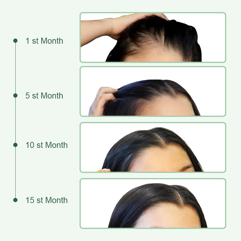 Curalona® 10-in-1 Scalp & Skin Firming, Sculpting & Anti-Hair Loss Renewal Serum  with Stem Cell–Derived Factors & Astaxanthin