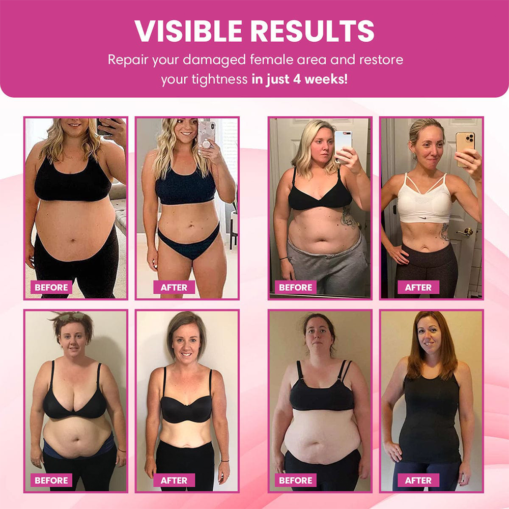 📢Curalona® Instant Itching Stopper & Detox and Slimming & Firming Repair & Pink and Tender Natural Capsules PRO