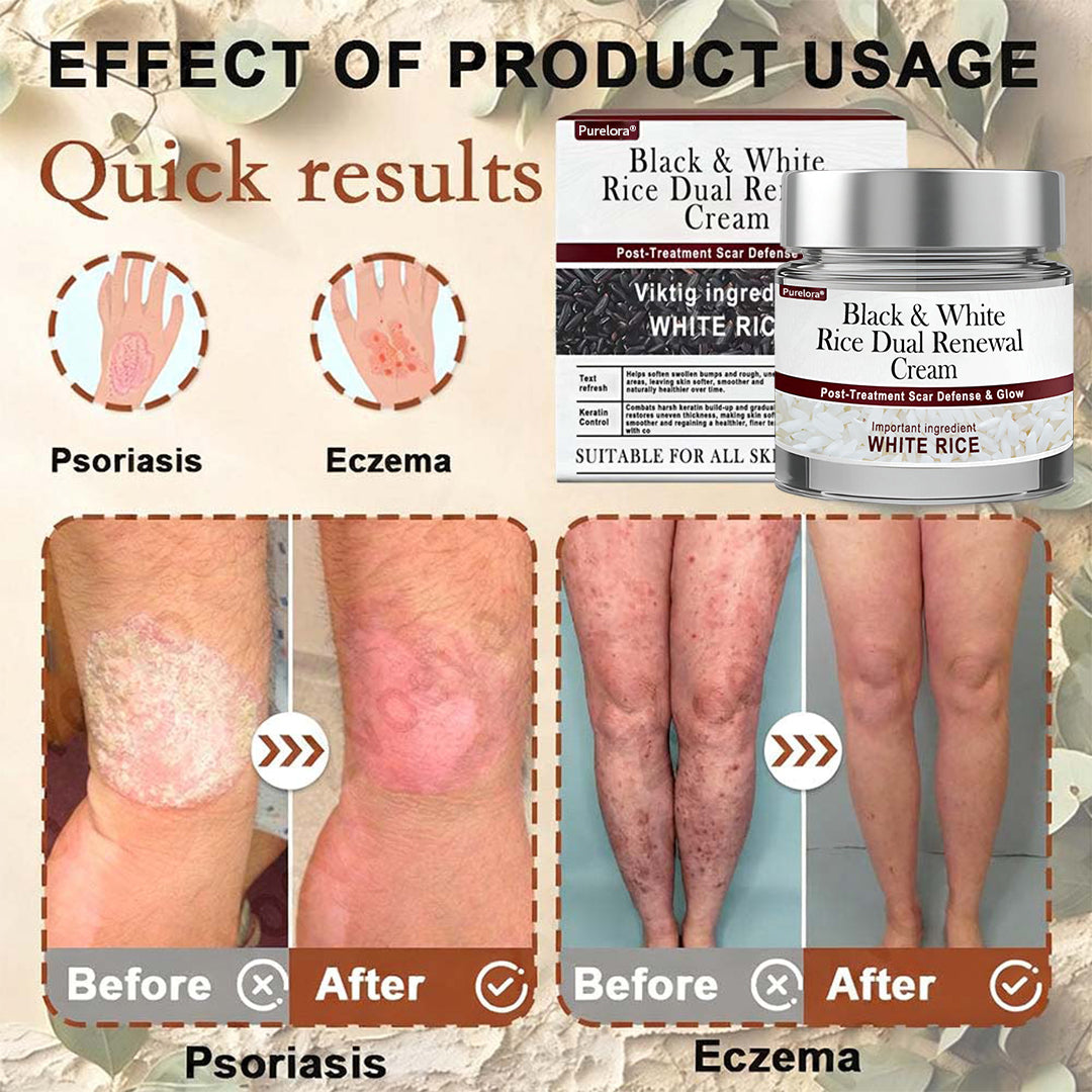Online Pharmacy | New Arrival Purelora® Black & White Rice Dual Renewal Cream (For removing warts, skin growths & keratin buildup, followed by intensive barrier repair to fade dark spots and prevent scarring)